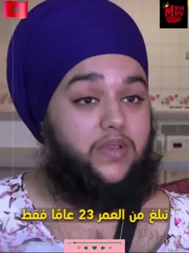 اول إمرأة بلحيه  #الشعب_الصيني_ماله_حل😂😂 #فرنسا🇨🇵_بلجيكا🇧🇪_المانيا🇪🇸 #france #treanding #explore 