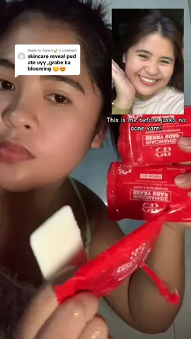 Replying to @Yanerrr🍃 Gatekeep ko sana ito ihh🥹 one of my secrets🫦 #glutathione #acnemarks #pekas #skincare #fyppppppppppppppppppppppp 