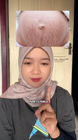 Wajib cobain dari sekarang buat bumil cantik #rintikskincareindonesia #perlengkapanibu #carahilangkanstretchmark #stretchmarkbiarpudar 