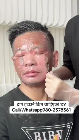 #stitch #stretchmarks #burnt #viralvideo #scar 