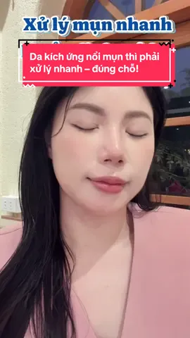 Da kích ứng nổi mụn thì phải xử lý nhanh – đúng chỗ! ICE LERSKIN giúp mình vượt qua mấy ngày da “khó ở”: ✨ 1 phút tạo màng trong suốt ✨ Giảm sưng nhanh – dịu da ✨ Không bong tróc – Makeup vẫn mượt #ICELERSKIN #TinhChatTriMun #SpotTreatment #DaKichUng #TriMunNhanh 