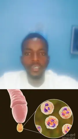 #Gonorrhea  #MensHealth  #STDawareness  #STIsymptoms  #SexualHealth 