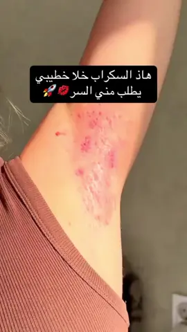 #مقشرات_طبيعيه_و_سكراب_و_زيوت #كريم-تفتيح#المديرة_الذهبية_هبة_خلف♕ #رهفـستايل #تفتيح_المناطق_الداكنة @🏅المديرة الذهبية هبة 🏅FARMSI @رهف ستايل 