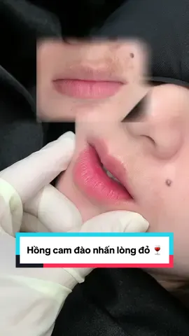 Khử thâm nhấn lòng cũng xinh lắm rồi #phunmoitunhien #phunmoitanvien #phunmoidanang #khuthammoinam #dieukhacchanmay 