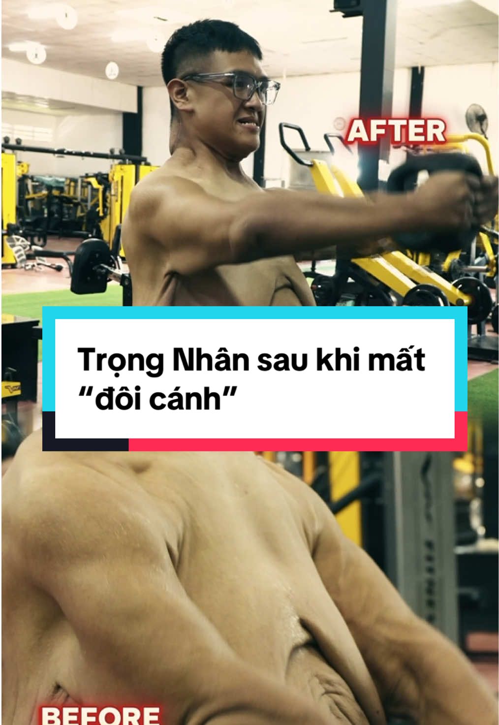 Trọng Nhân sau khi mất “đôi cánh”. #byebeo #trongnhanbyebeo #trongnhantaitaobody 