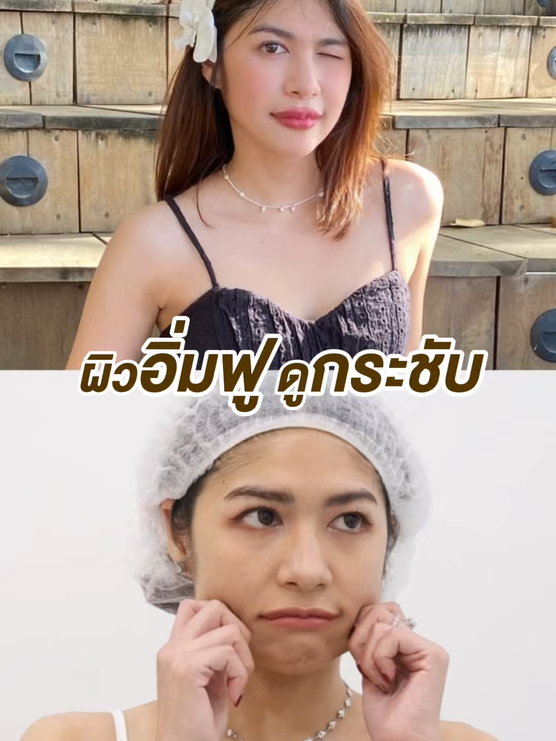 ผิวฟูกระชับกว่าที่เคย ไปกับโปรแกรม #Hifu เครื่องเล็กๆแต่หน้ายกสุด ! ไม่เชื่อพิสูจน์กันได้ที่ #Thephubangkokclinic . #ความสวยที่ใช่ต้องไปเดอะภู #คลินิกเสริมความงาม #คลินิกใกล้ฉัน #เดอะภูแบงค็อก