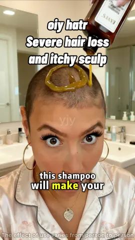 Follow me, and you can also have thick hair#shampoo #blackfriday #hairloss #plant #Ginger