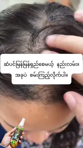 #ဆံပင်အရှည်မြန်ဆီ  #ဆံပင်ပေါက်ဆေး  #ပေါက်စမ်းရောက်စမ်း  #ဆံပင်ပြသနာရှိသူတိုင်းကြည့်ပေးပါ 