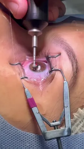 Cara alami bantu jaga kesihatan mata!#A01