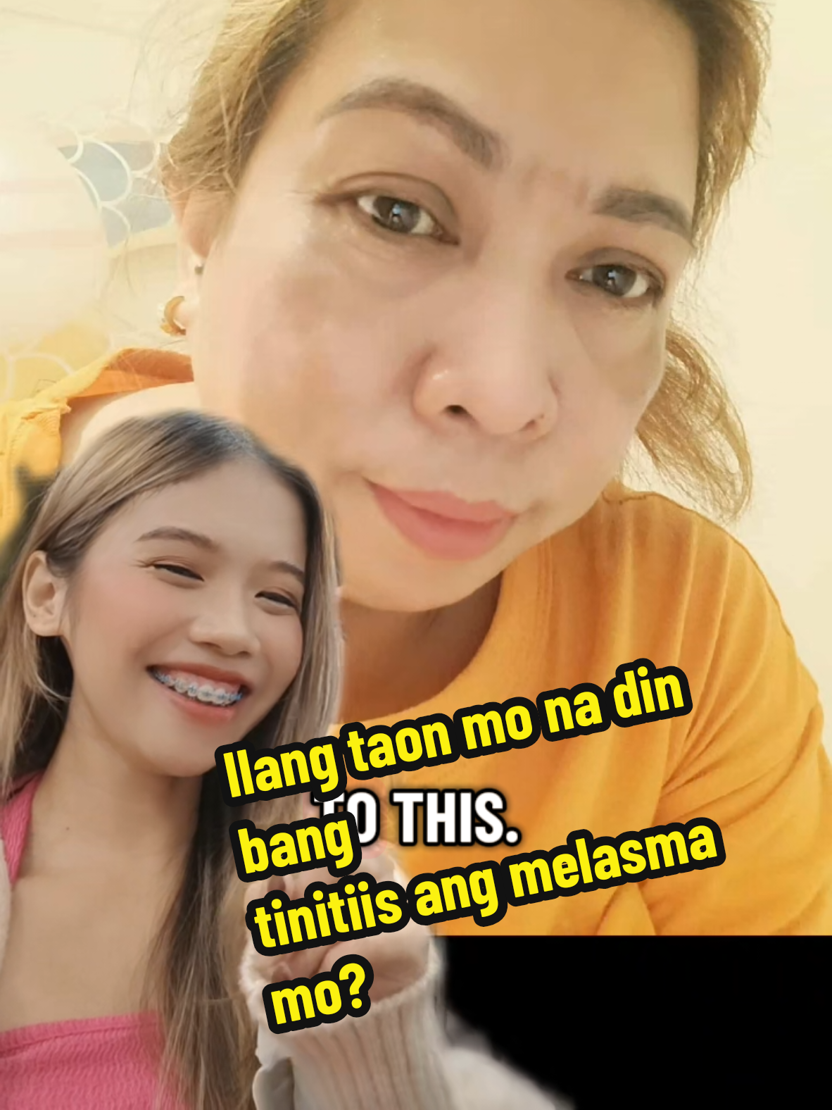 Ilang taon mo na bang tinitiis ang melasma mo? #melasmaskincare #melasmatreatment #btyadvance #btyadvance #ccgrayskincare 