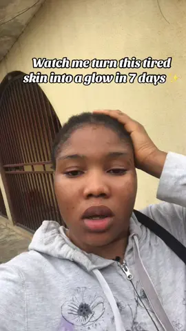 Day 1 my skin was dull and uneven. I added a simple routine: gentle cleanser, hydrating toner, niacinamide, and moisturizer with sunscreen daily. By day 7, my skin looked brighter, smoother, and glowing. Consistency is everything! Follow for more skincare glow tips 💛 #glowingskin #skincareroutine #skincaretips #beforeandafter #fyp
