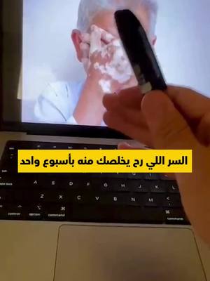 فلوسك ترجع إذا ما شفت الفرق