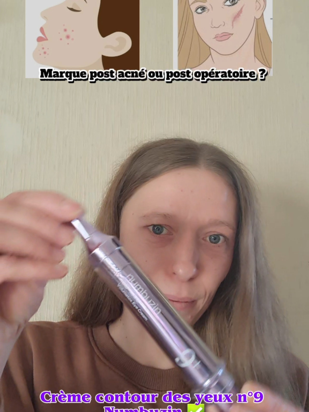 💜💉 Crème yeux n°9 Numbuzin = Crème réparatrice Coréenne  Parfait pour diminuer vos marques d'acné ou les marques post opératoire✅️ @numbuzin  #skintreatment #scarcream #retinol #nadeyecream #numbuzin @numbuzin_global_MKT 