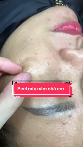 Peel mix nám nhà em 🥰