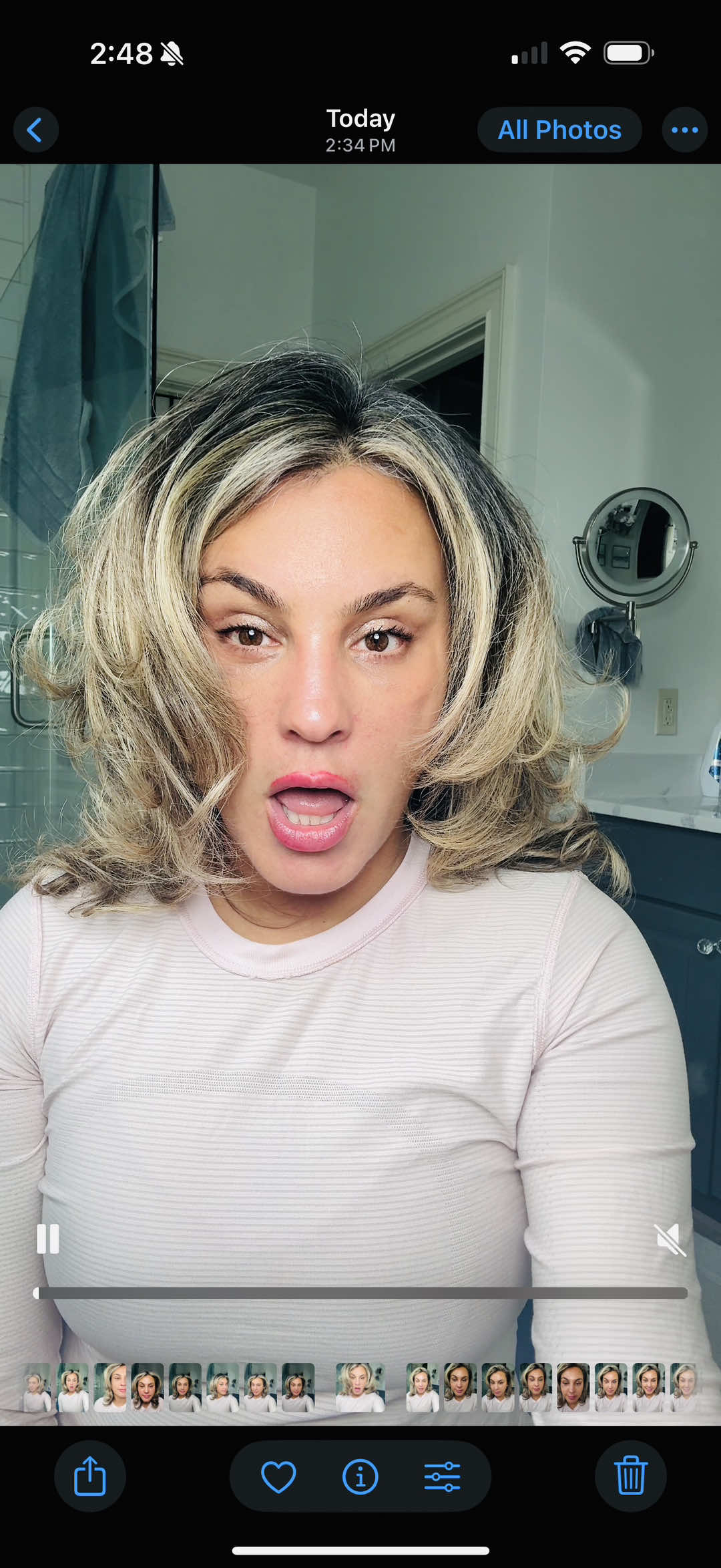 Healing and loving it! #ponytailfacelift #browlift #upperbleph #deeplane 