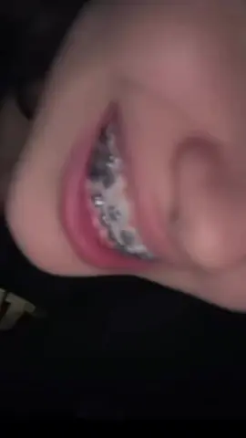 احد عنده حل للشد ؟😔😔#foryoupage #الرياض_جده_مكه_الدمام_المدينه #مستشفى #f #fypシ 