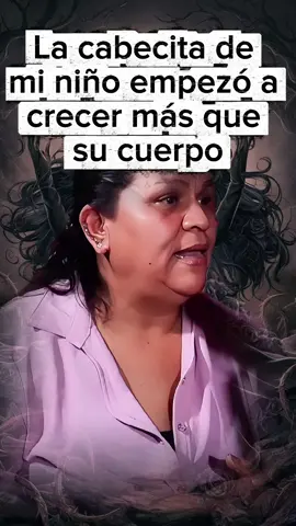 La cabecita de mi niño empezó a crecer más que su cuerpo#brujerias ##maldad #Terror #miedo #real #amarresdeamor #esmeralda01o 