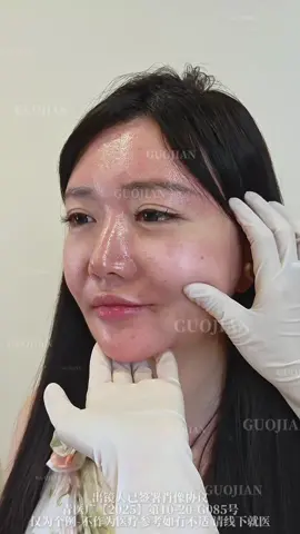 #9DLift #NaturalAesthetics #FaceRefinement #GlowUpStory #变美逆袭 