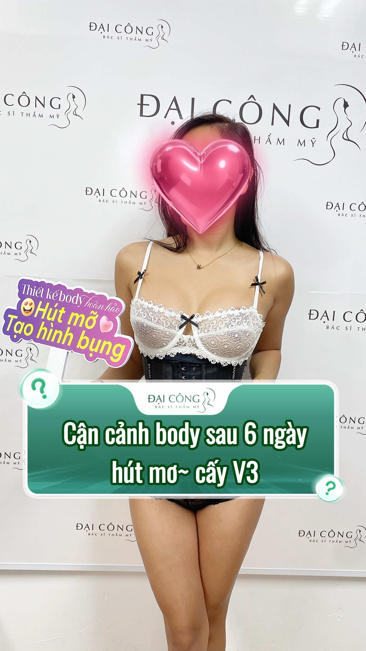 Cận cảnh body sau 6 ngày hút mơ~ cấy V3 #bacsinguyendaicong #nguyendaicong #hutmobung #cayv3 #caymong 