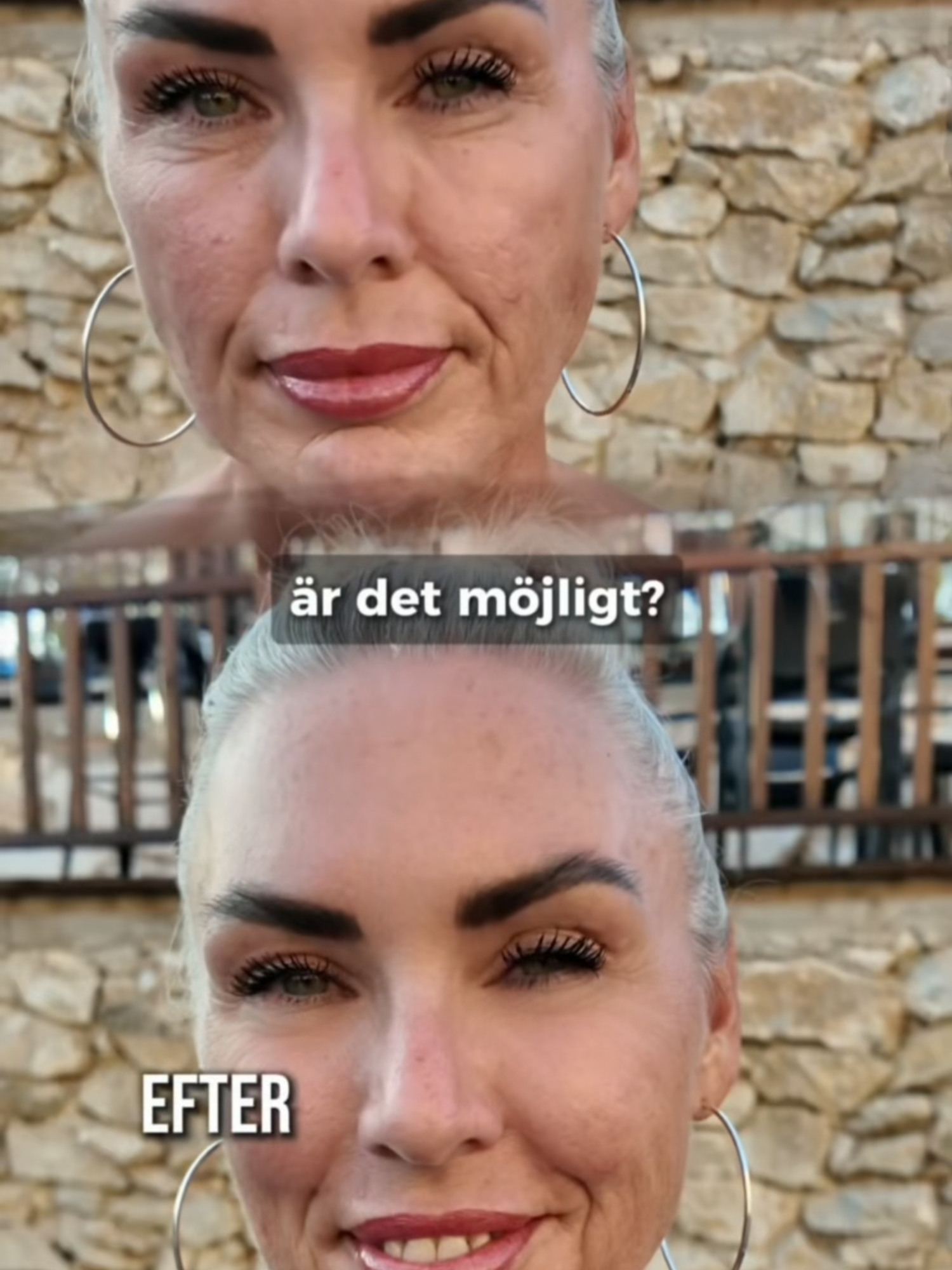 ⚫ BLACK FRIDAY MEGADEAL! 🟡 🖤 50% RABATT + GRATIS Ögonkräm + 🚚 FRI FRAKT 💛 Minska påsar under ögonen och rynkor på bara 60 sekunder! 😍✨ #BrightUp #BlackFriday