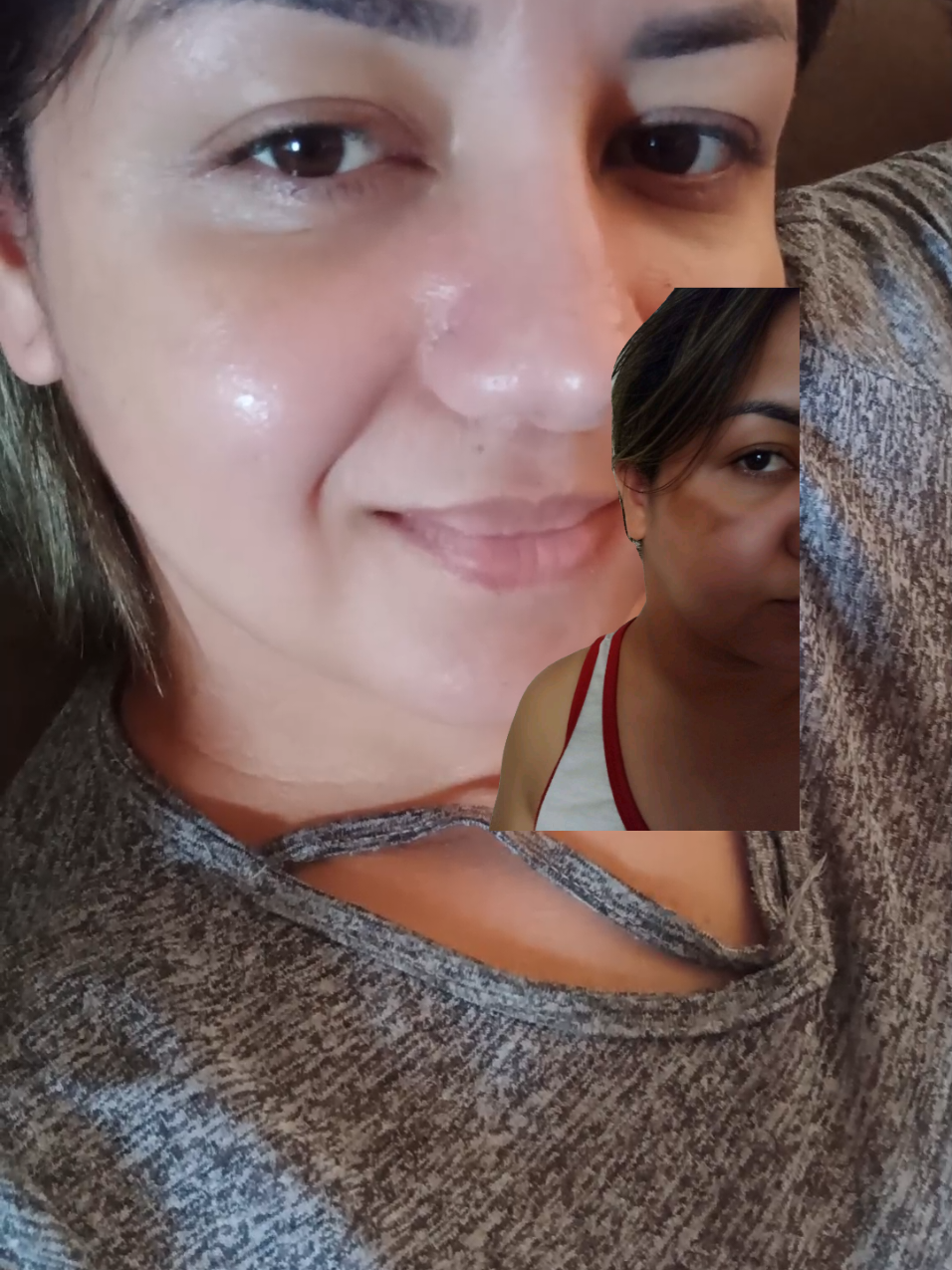 Poucas pessoas sabem que esse clareador faz milagres. melasma  manchas no rosto  manchas na pele  #ClareamentoDeManchas #PeleSemManchas #AdeusManchas #ManchasNaPele #ClarearManchas