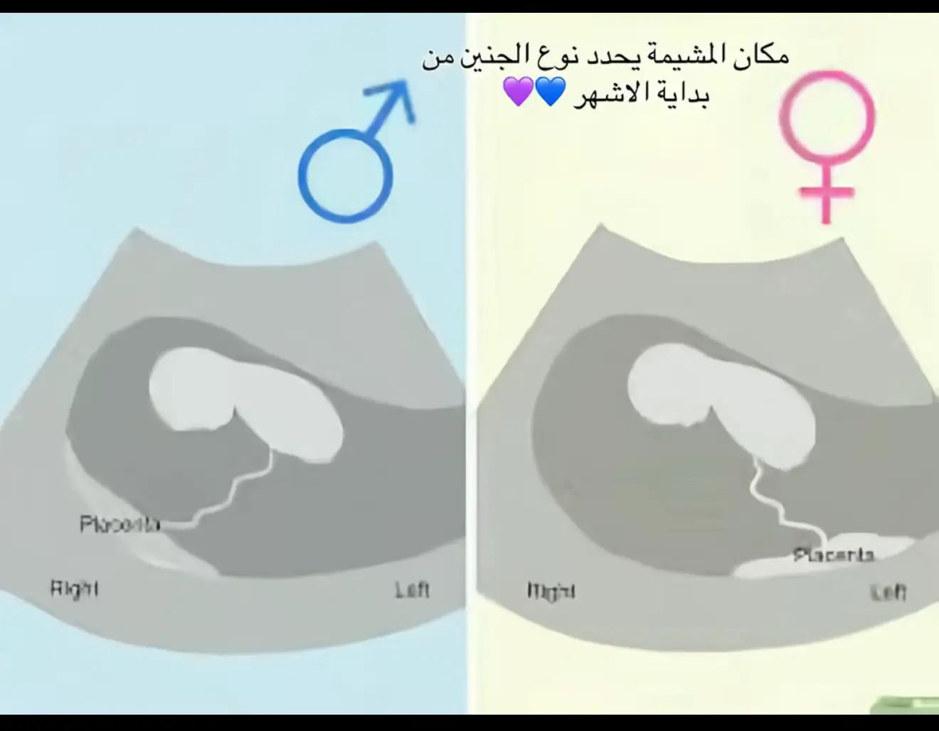 #الشعب_الصيني_ماله_حل😂😂 # #نوع_الجنين #سونار  #اكسبلور 