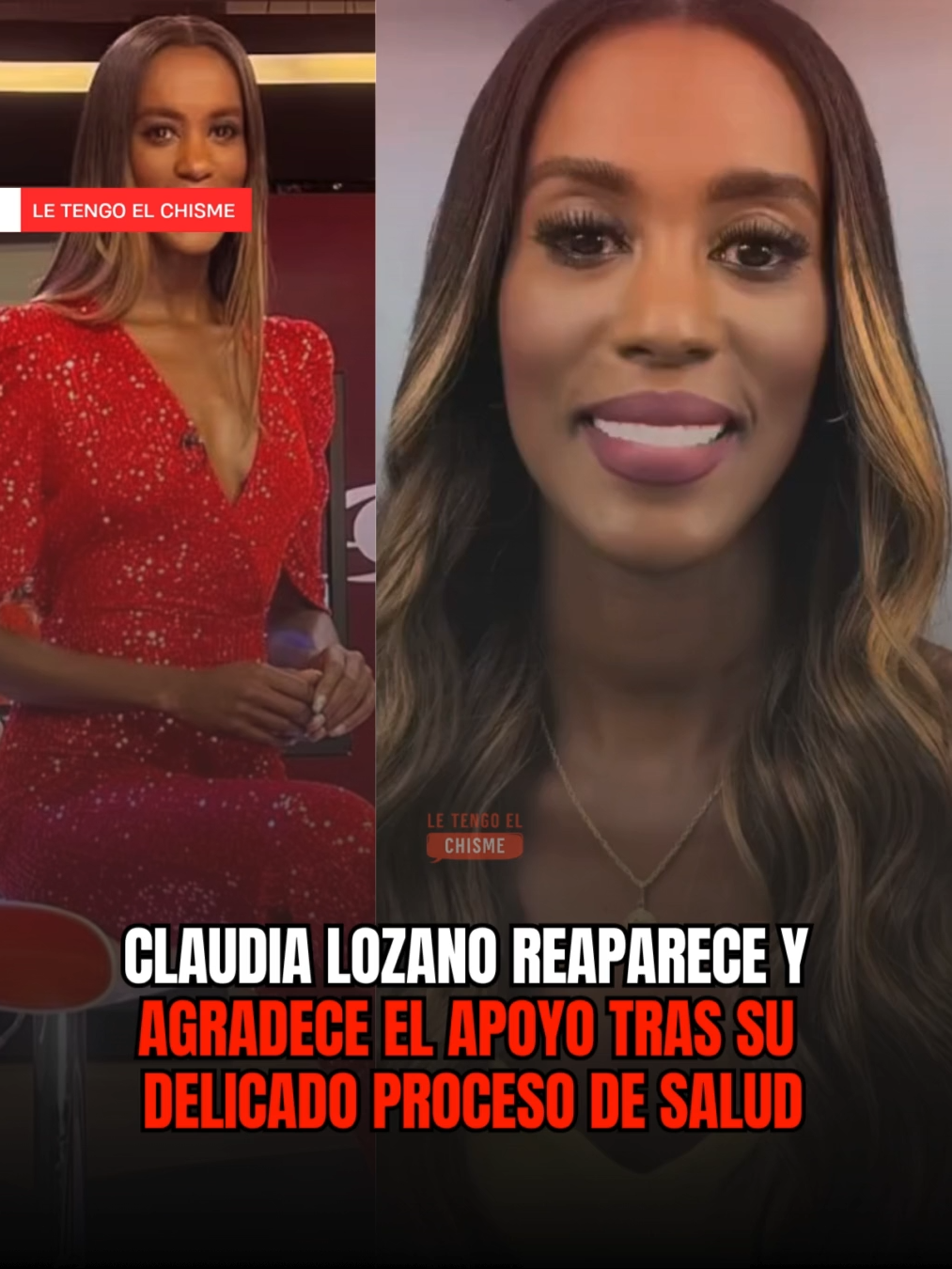 Claudia Lozano, presentadora de Show Caracol, reapareció con un mensaje lleno de gratitud y alivio ❤️✨. En el video, la periodista compartió que ya se encuentra mucho mejor después de enfrentar un complejo proceso de salud que incluso la llevó a estar varios días en cuidados intensivos 🙏💙. Claudia agradeció a su público por los mensajes, a su equipo de Show Caracol y al personal médico que la acompañó en este camino. “Fueron días difíciles, pero hoy puedo decirles que estoy bien”, expresó con emoción 🤍✨. Su regreso ha sido recibido con cariño por sus seguidores y colegas, quienes celebran que esté nuevamente en recuperación. 🌟💪