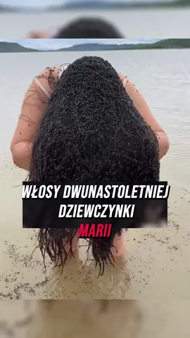 Włosy 12-letniej dziewczynki, Marii, były całkowicie pełne wszy, a to, co lekarze odkryli w jej głowie, wstrząsnęło całym światem.