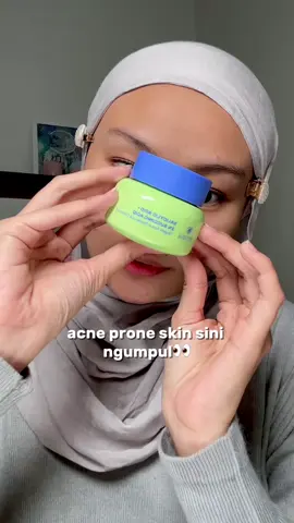 Acne prone skin sini ngumpul 👀💚 #emina #acnefighter #moisturizer #moisturizerviral 