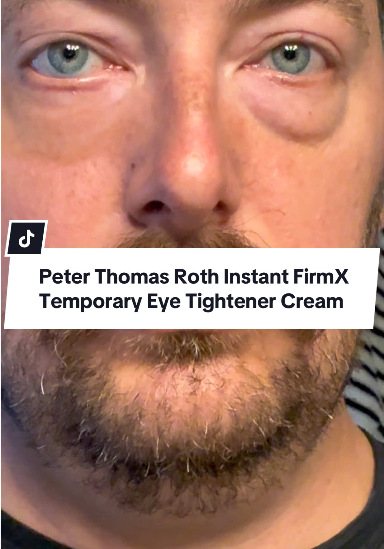 Is this eye tightening cream a hoax? Just look at my treated eye bag and my untreated eye bag… I’ve had eye bags since my 30’s and when they say this @Peter Thomas Roth Labs Instant FirmX Temporary Eye Tightener Cream actually VISIBLY reduces the appearance of eye bags, fine lines, and wrinkles… they weren’t joking. Works within minutes and lasts for hours. #peterthomasrothinstantfirmx #ptr #undereyebags #eyebags #crowsfeet 
