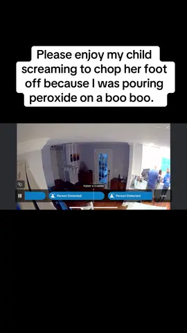 After a scooter wreck today, things got a little dramatic 🤣 In the next video was her yelling “the pain, the horror, the terror!”  #parenting #kidsoftiktok #kidsbelike #dramatic 