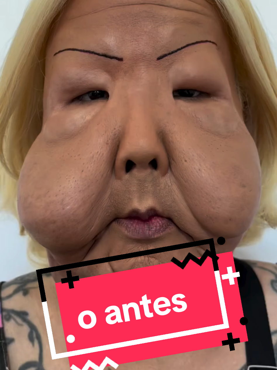 Juju do Pix no pré operatório. ela será operada no hospital Indianópolis em São Paulo por Dr Marra 