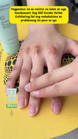 🤩💗Ang SHEEureka Herbal Exfoliation Limited Time Event ay isang bargain! 1000000 item ang naibenta sa Tiktok at nakatanggap ng maraming papuri mula sa mga customer! Ito ang SHE 'Eureka Brightening Exfoliating Gel! Ang sarap talaga mag-apply. Ilapat mo lang sa mukha mo at hulaan mo? Hindi ka makakaramdam ng sakit! baliw!👉🏻🥰 #exfoliatinggel #bodyscrub #beauty #fyp #skincare PH5894