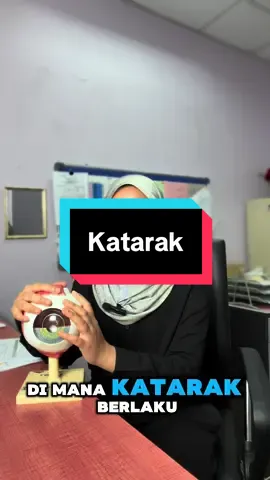 Apa itu katarak? Dr. Wan Farah terangkan dalam video kali ini!. Tanda, punca & bila perlu rawatan — semua ringkas dan mudah faham 💡 #fyp #katarak #eyes #foryou #sakit 