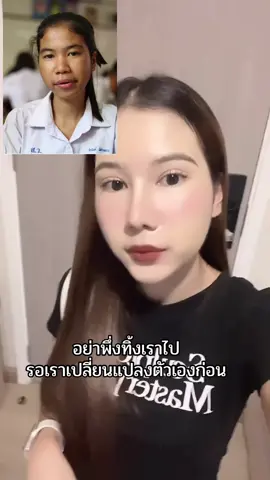 ไหนๆตอนนั้นใครบูลลี่ฮะ ! #ศัลยกรรม #เปลี่ยนแปลงตัวเอง #ศัลยกรรมเปลี่ยนชีวิต #fyppppppppppppppppppppppp #ฟีดดดシ 