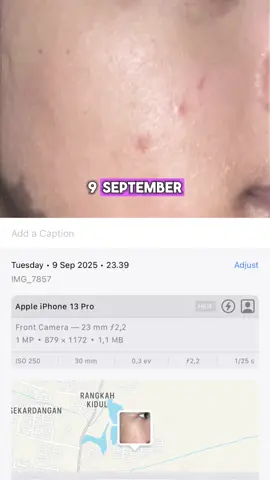 Journey yang gak bakalan bisa mimin lupain💓 #toner #brighteningtoner #whitediary #calmingtoner 