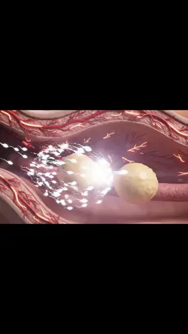 Twins baby inside view in mother #anatomy #healthylifestyle #viral #fyp #human 