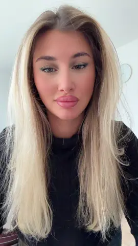 Süße Spangen🥰🥰 #fy#cool 