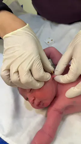 Baby earring #doctorbaby 