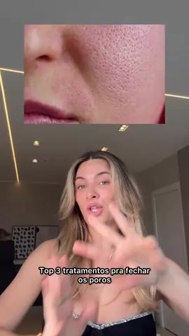 Quem aí tbm sofre com poros dilatados? 😮‍💨