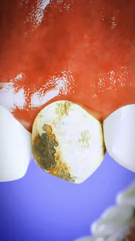 Having Gold Teeth Can Be Painful 😱