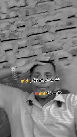 #خال رتوله✌️❤️ #سودانيز_تيك_توك_مشاهير_السودان💜🇸🇩💜  #الشعب_الصيني_ماله_حل😂😂🙋🏻‍♂️💜  #جوكيه_السودان_مشاهير_تيك_توك_السودان  #سواقين 