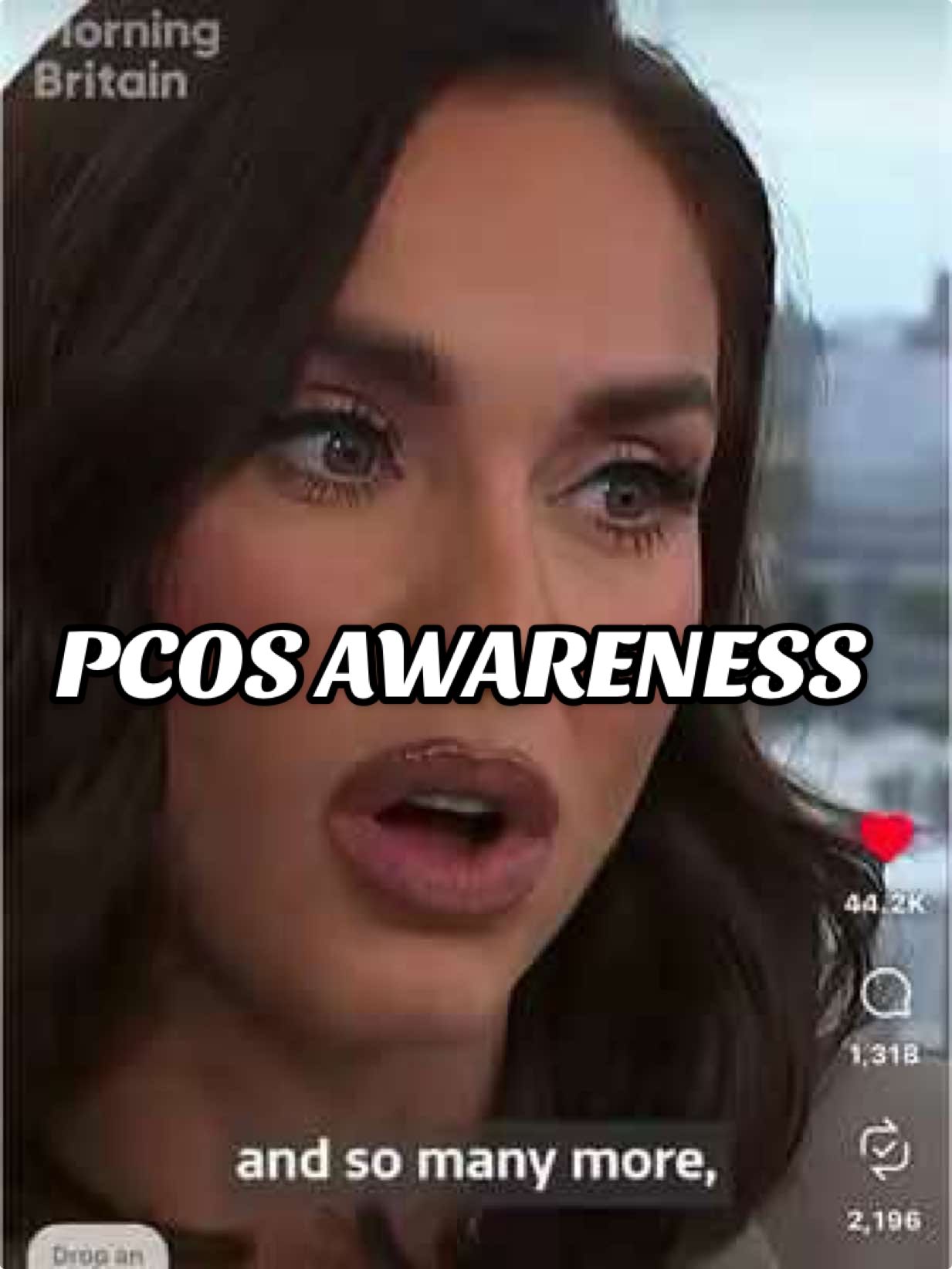 Women are being dismissed, misdiagnosed and left in pain for YEARS and I’m one of them. ! 💔❤️‍🩹 I’ve done every scan, every referral, sat in A&E for 24 - 30 hours at a time, cried in waiting rooms, been told my symptoms were  “normal”,  “just hormones”  “lose weight” “take painkillers” I even had a male gynae tell me “ I know how you feel.” And then on top of all that… I was put to sleep for a full investigation for endometriosis, and they did the wrong surgery. This isn’t an isolated story. It’s happening to women everywhere young women, bigger women, neurodivergent women, women of colour we’re ALL being overlooked. 84% of women say they haven’t been listened to by healthcare professionals. Only 2% of medical research funding goes to female reproductive health. And conditions like endometriosis take an average of 9 years to diagnose. How is that acceptable in 2025 ⁉️ I’m tired of being quiet. I’m tired of women being brushed off. I’m tired of girls thinking their pain is “just part of being a woman.” Our pain is REAL. Our experiences are REAL. And we deserve proper care, proper research, and to be taken seriously the first time we speak not the tenth. I’m using my platform to talk because nothing changes if we stay silent. If my story can help one girl feel less alone, or push this conversation into the rooms where decisions are made, then I’ll keep talking. Women deserve answers. We deserve dignity. We deserve better. And I won’t stop saying it until the system finally listens. 📢✨ - #pcos #endometriosis #womanshealth #awareness  - @GoodMorningBritain @Vicky Pattison #news @Sky News @BBC News 