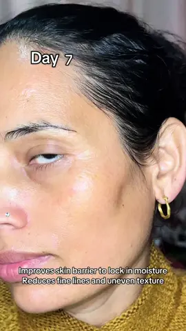 Dark spots gone in 7-days @KSECRET GLOBAL #GLOWSHOTCHALLENGE #KSECRET #seoul1988 #darkspots #creatorsearchinsights 