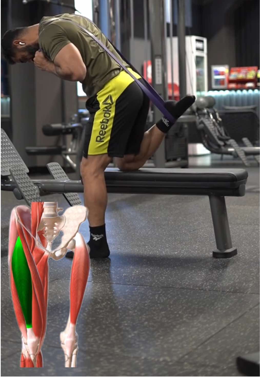 #kneepain  Stronger and Stable Knees with Simple Resistance Band Exercises! 💪🦵 Want stronger knees and thighs? Resistance band exercises are a simple and effective way to increase strength and stability in your lower body joints. Just a few short movements a day can help you: ✅ Improve movement performance in sports and daily life ✅ Reduce the risk of knee injuries ✅ Increase lower body strength and balance Start today and feel the difference! #HealthyKnees #ResistanceBandWorkout #ThighStrength #homeworkout 