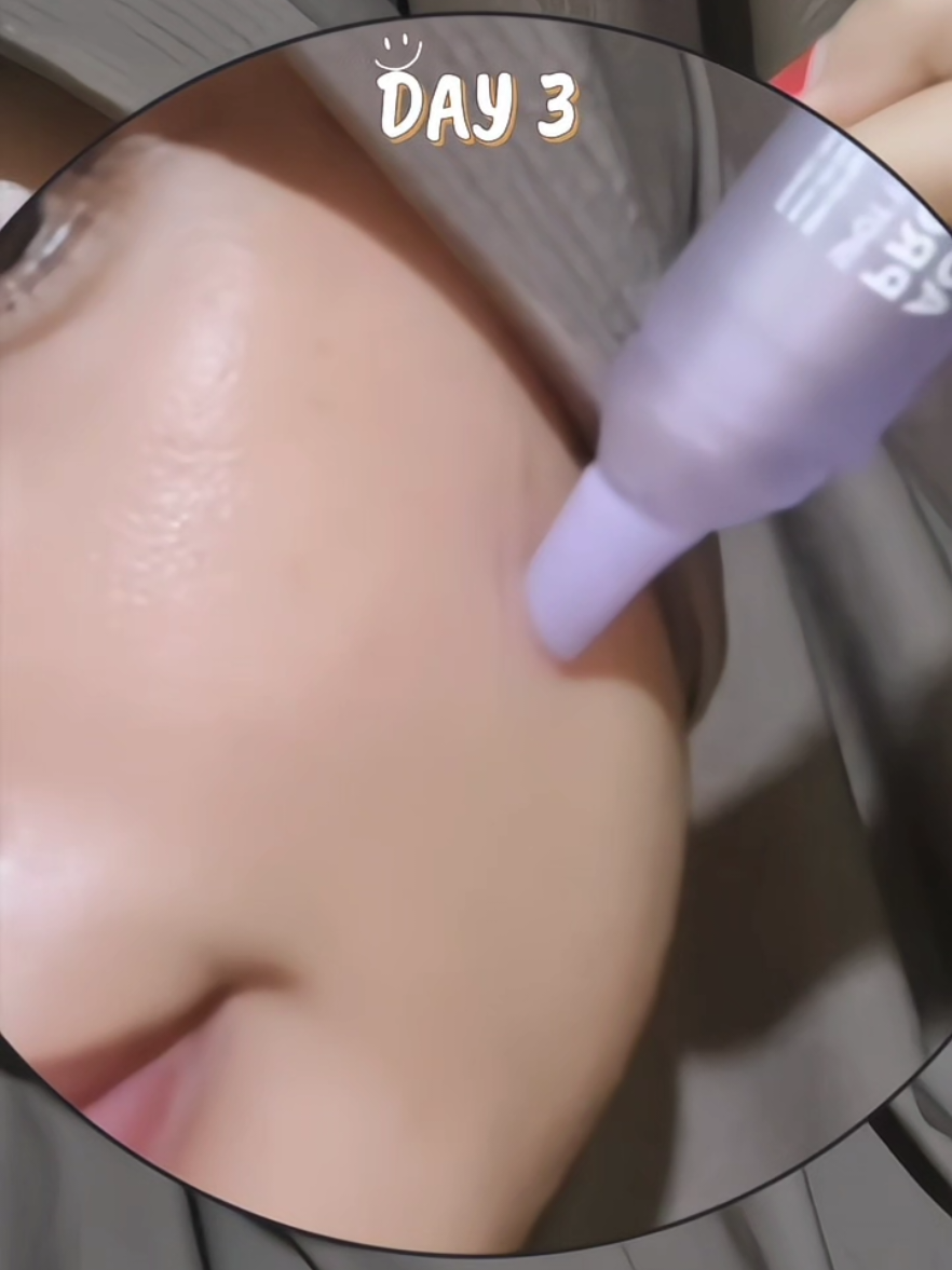 masyallah 😍 #acnespotffy #acnespottreatmentffy #finallyfoundyou #obatjerawatffy #fyp 