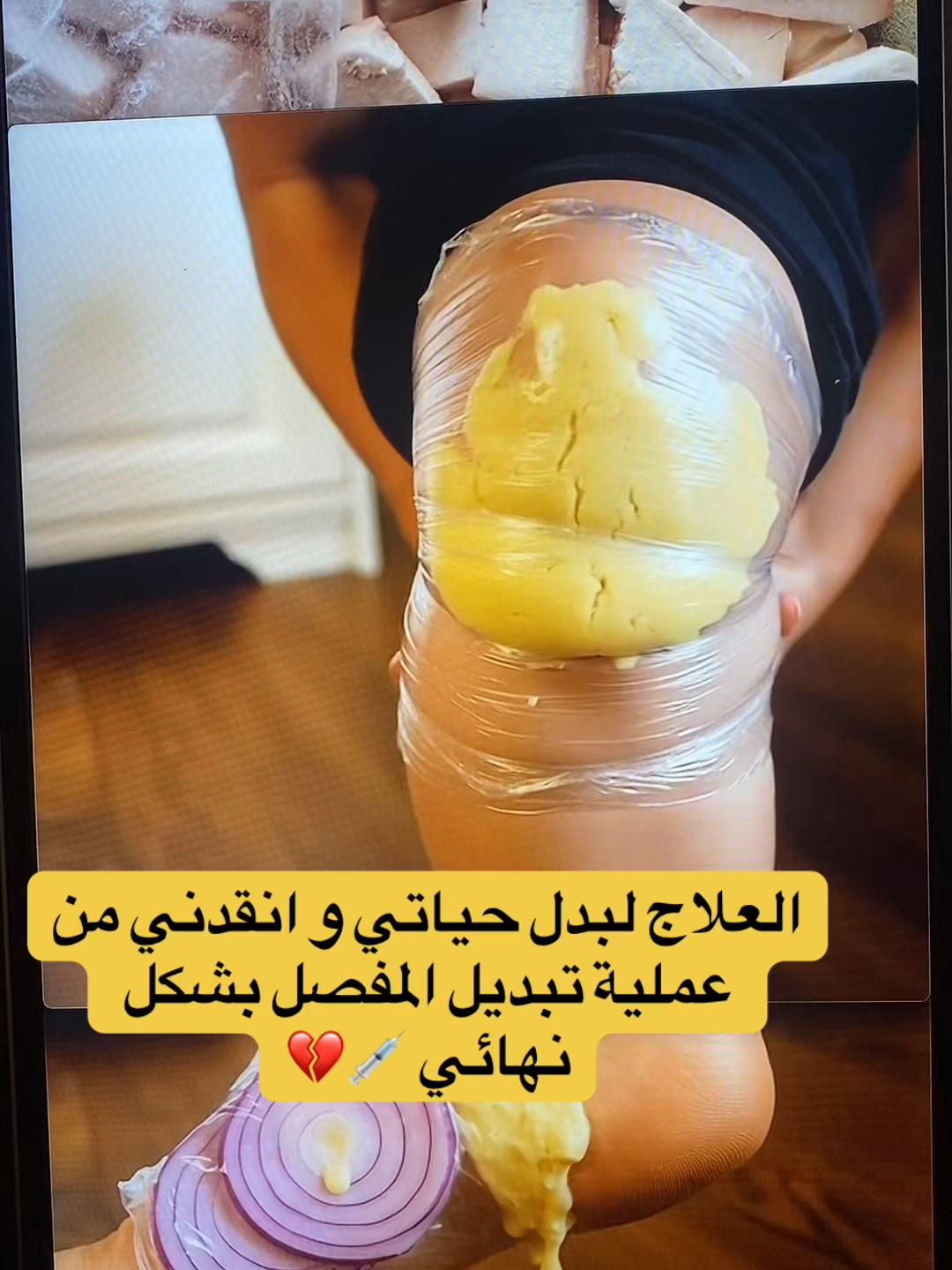 #خشونة_الفقرات #عرق_النسا #التهابات_المفاصل_وغضاريف_الركبة #خشونة_مفاصل_الركبة #خشونة_المفاصل #الرقبة #السعودية #اليوم_الوطني #الرياض_الان_ #مكه #جدة_الان #المدينة_المنورة #الدمام_الخبر_الاحساء_الجبيل_الظهران #الدمام_الخبر_الشرقيه_الاحساء_الهفوف #اليوم_الوطني_السعودي_94 #ألم #اليوم_الوطني_السعودي_٩٤