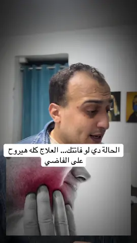 #fyp #explore #capcut #الدكتور_محمود_الكلاف #creatorsearchinsights 