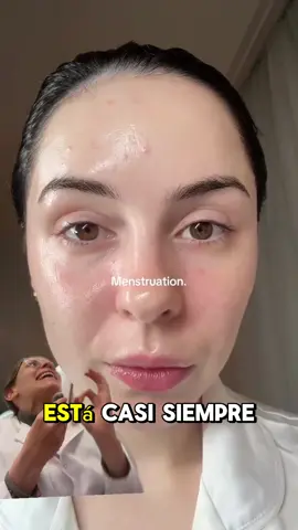 Tu piel a lo largo del mes, no es siempre igual, te explico el por qué, y que hacer al respecto 😃 . . . #drapascali #ciclomensturalovulatorio #ovulación #skincare #skincaretips 