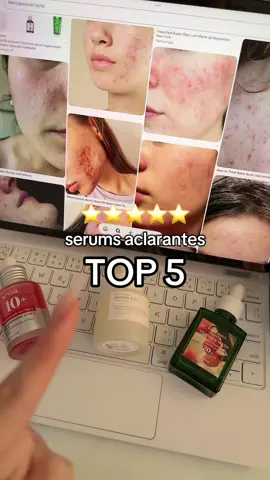 Top 5 serums aclarantes para la carita ❤️✅ sobre todo si tienes manchitas por el acné, por el sol o zonas oscuras en tu cuerpo #skincare #koreanskincare #skincarecoreano #rutinadeskincare #acne 